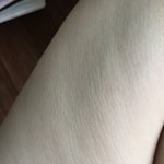 허벅지 <b>줄무늬</b>