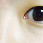 [꼭조언부탁] <b>쌍수</b> ) 해라 / 하지마라 