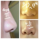 내 코 어때?