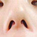 아는앤데 이코 성형한거임??