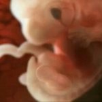 <b>태아</b>를 기생충같다고 한애