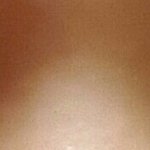 [꼭조언부탁] 쌍커풀성형 (사진)