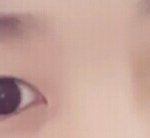 제눈<b>사시</b>?사팔인가요?(사진)