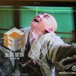 [조언부탁해] 나 급진성 발작 <b>흉부</b>염이라고 희귀병 환잔데