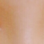 나 <b>쌍수</b>했는데..ㅜㅜ