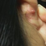 [조언부탁] [약혐주의]피어싱<b>염증</b>ㅠㅠㅠㅠ조언좀