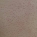 [댓글부탁해] 혐) 나 <b>모공</b>이 너무 넓ㅇㅓ...ㅠㅠㅠㅠㅠㅠ