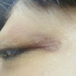 [댓글부탁해] <b>눈옆</b>에멍어떡해없애?ㅠ