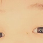 [댓글부탁해] 무보정인데 눈지방제거 <b>각인</b>갛ㅎㅠ