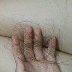 학교가다 미친여자한테 맞고 학교결석했어요