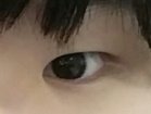 [댓글부탁해] 성형 결심 후 후기 잘된거 맞아? (추가)