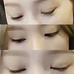 [태연] 쌍수논란 <b>종결</b>하고 갈게요