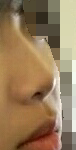 <b>코</b>랑<b>입</b>좀봐줘 ㅠㅠ