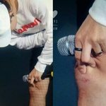 [카이] 종인이 무릎까졌어ㅜㅜ