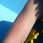 신혼여행중에.... 꼭 좀 조언부탁드립니다ㅠㅠ (혐오사진주의!!)