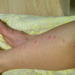 [꼭조언부탁] <추가>새로 이사 온집 진드기