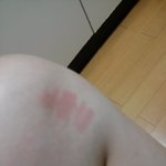 약을 끊고싶어요