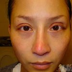 Yumi wong 黄诗棋 成形前 你假冒