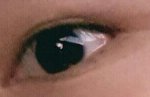 +수정) 앞트임했는데 <b>티나</b>?