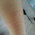 [드루와] +추가 <b>사진약</b>혐) 피부묘기증있는사람있어?