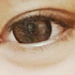 [극혐<b>주</b>의] ㅁㅊ쌍수 개망했다 (<b>사진</b>ㅇ)