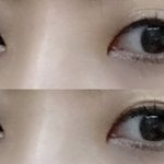 쌍수할까요.......?