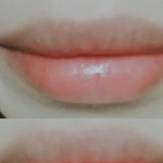 입술때문에 미치겟어...