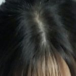 나 <b>탈모</b>야????ㅠㅠ
