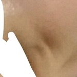 입옆에보조개임머임<b>주름</b>임?