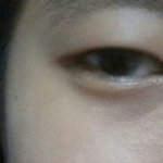 나<b>짝눈</b>인데빨리쌍수하고싶다