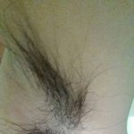 여자인데 <b>겨털</b>이 너무 길어요..(사진있음)