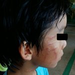 (사진) 학교폭력 피해자 엄마입니다. 가해자의 횡포, 어디까지 참아야...