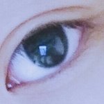 이런 쌍커풀 모양으로 수술하려는데 <b>티</b> 날까?