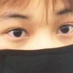 [EXO] 카이 일본에서 쌍수 재수술했네