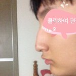 매<b>부리</b>코심한거에요?
