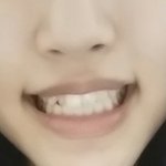 얘들아 나 웃을때 치아 좀 봐주라 ㅠㅠ