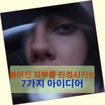 붉어진 피부를 진정시키는 7가지 아이디어