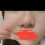 [댓글부탁해] <b>볼살</b>때문에 스트레스