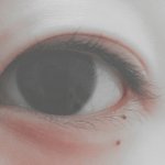 [조언부탁] <b>뒤트임</b>, 앞트임, 그리고 쌍수..?