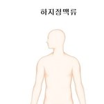 [건강] ** ‘하지정맥류’, 예방에서 치료까지 **