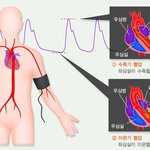‘고혈압’을 이기는 식사 요령 ‘고단백 <b>저탄</b>수화물’의 식생활이 해답...