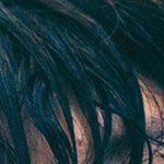 [방탄소년단] 이거 <b>호석</b>이 뾰루지 난거야 ?
