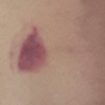 [꼭댓글부탁] 이거 키스<b>마크</b>맞져 ㅠㅠ