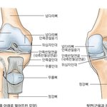 [건강] ** 참을 수 없는 ‘무릎 <b>통증</b>’, 인공<b>관절</b>로 해결한다...