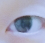 [댓글부탁해] <b>쌍수</b>할까말까 ㅠㅠ