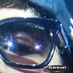 [EXO] 존나 또라이년들아 얘 눈에 <b>염증</b>나서 그런건데