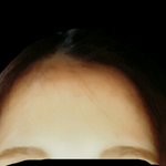 [댓글부탁해] <b>이마</b> 좁아보이는법좀 알려줭ㅠㅠ