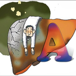 [건강] ** ‘후진국형 질병’, <b>A</b>형 간염, 대처법 **