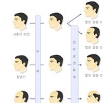 [출산가사] ** ‘탈모’에서 탈출하자! **
