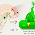 [건강] ** ‘파킨슨병’ 제대로 알기 **